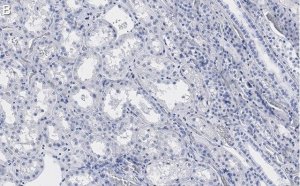 Anti-PP2A C subunit Antibody, clone 2B15 ZooMAb� Rabbit Monoclonal 