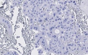 Anti-PPAR Antibody, clone 1I19 ZooMAb� Rabbit Monoclonal 