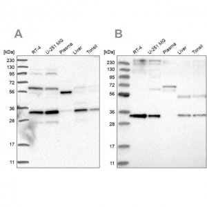 Anti-PPCS antibody produced in rabbit 