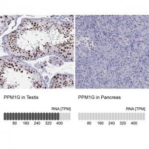 Anti-PPM1G antibody produced in rabbit 