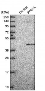 Anti-PPM1L antibody produced in rabbit HPA019891-100UL