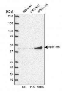 Anti-PPP1R8 antibody produced in rabbit 
