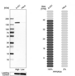 Anti-PPP2R3A antibody produced in rabbit 