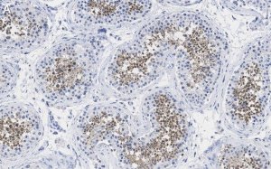 Anti-PPP3CC Antibody, clone 2C2 ZooMAb� Rabbit Monoclonal 
