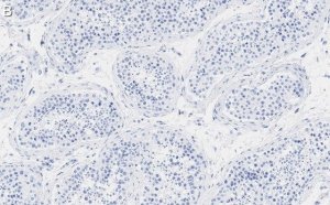 Anti-PPP3CC Antibody, clone 2C2 ZooMAb� Rabbit Monoclonal 