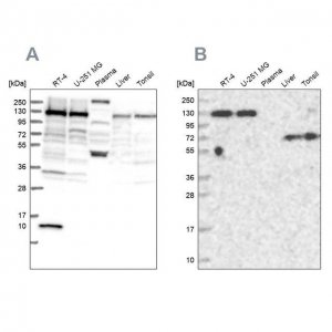 Anti-PPP4R1 antibody produced in rabbit 