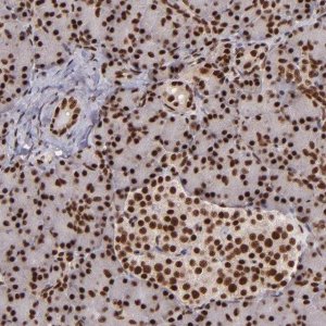 Anti-PQBP1 antibody produced in rabbit 
