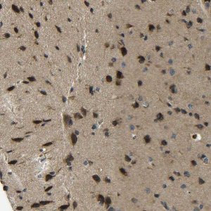 Anti-PREB antibody produced in rabbit 