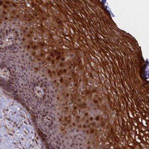 Anti-PRELID2 antibody produced in rabbit 