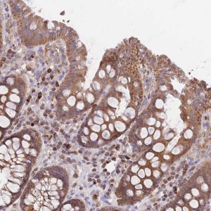 Anti-PREP antibody produced in rabbit 