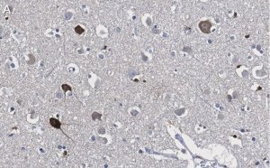 Anti-Prion Protein Antibody, clone 3D17 ZooMAb� Rabbit Monoclonal 