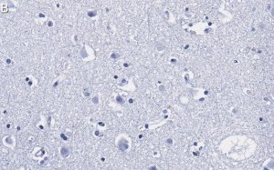 Anti-Prion Protein Antibody, clone 3D17 ZooMAb� Rabbit Monoclonal 