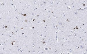 Anti-Prion Protein Antibody, clone 3F17 ZooMAb� Rabbit Monoclonal 