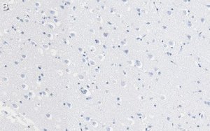 Anti-Prion Protein Antibody, clone 3F17 ZooMAb� Rabbit Monoclonal 
