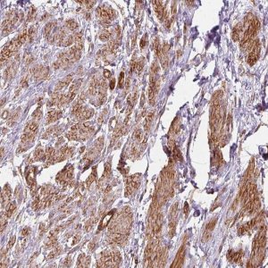 Anti-PRKCDBP antibody produced in rabbit 