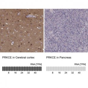 Anti-PRKCE antibody produced in rabbit 