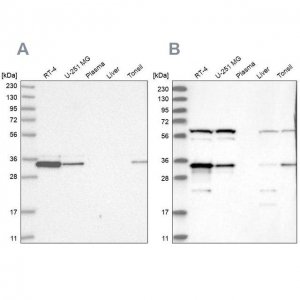 Anti-PRKRA antibody produced in rabbit 