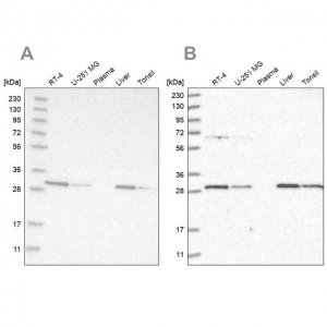 Anti-PROSC antibody produced in rabbit HPA023646-100UL