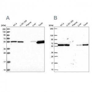 Anti-PRPF19 antibody produced in rabbit 