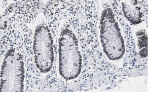Anti-PRPF19 Antibody, clone 1K10 ZooMAb� Rabbit Monoclonal 
