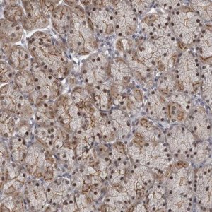 Anti-PRPF3 antibody produced in rabbit 