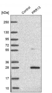 Anti-PRR13 antibody produced in rabbit HPA046219-100UL