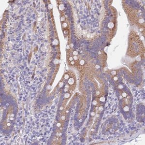 Anti-PRR13 antibody produced in rabbit HPA046219-100UL