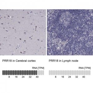 Anti-PRR18 