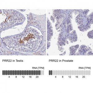 Anti-PRR22 antibody produced in rabbit 