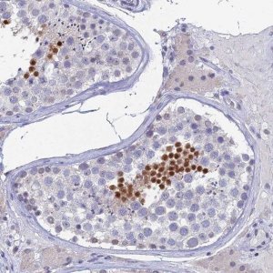 Anti-PRR22 antibody produced in rabbit 