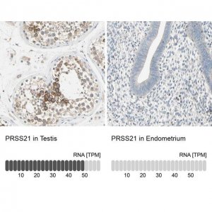 Anti-PRSS21 antibody produced in rabbit 