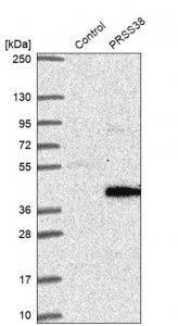 Anti-PRSS38 antibody produced in rabbit 