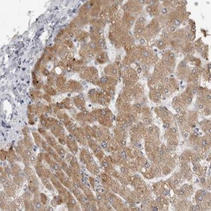 Anti-PRSS38 antibody produced in rabbit 