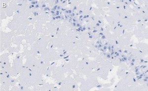 Anti-PSD95 Antibody, clone K28/43 ZooMAb� Mouse Monoclonal 