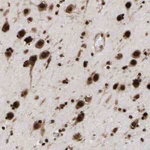 Anti-PSIP1 antibody produced in rabbit 