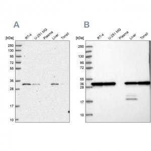 Anti-PSMA1 antibody produced in rabbit HPA043891-100UL