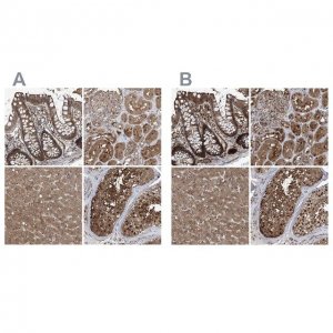 Anti-PSMB1 antibody produced in rabbit 