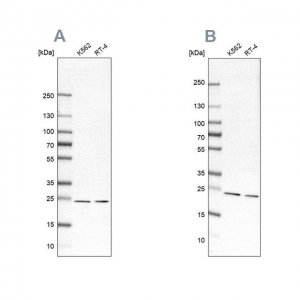 Anti-PSMB1 antibody produced in rabbit 