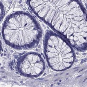 Anti-PSMB11 antibody produced in rabbit 