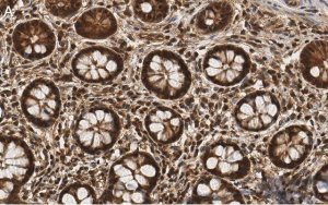 Anti-PSMB2 Antibody, clone 2N18 ZooMAb� Rabbit Monoclonal 