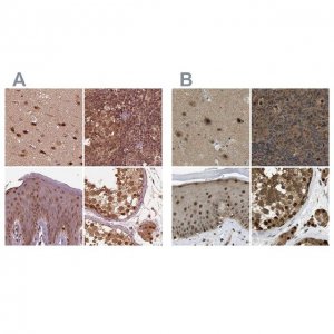 Anti-PSMC5 antibody produced in rabbit 