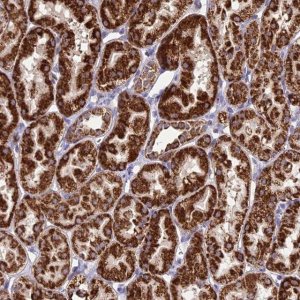 Anti-PSMD2 antibody produced in rabbit 
