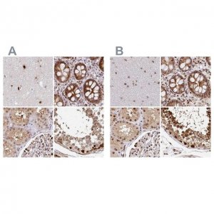Anti-PSMD7 antibody produced in rabbit 