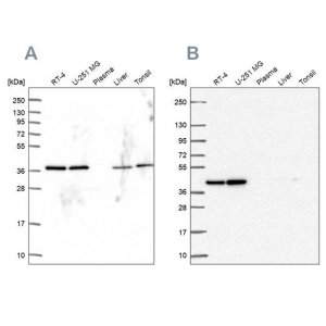 Anti-PSMD7 antibody produced in rabbit 