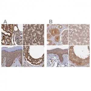 Anti-PSMD9 antibody produced in rabbit 