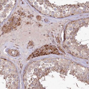 Anti-PSTK antibody produced in rabbit 