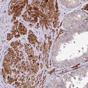 Anti-PSTK antibody produced in rabbit 