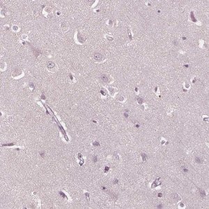 Anti-PSTPIP2 antibody produced in rabbit 