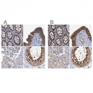 Anti-PTGES3 antibody produced in rabbit HPA038672-100UL