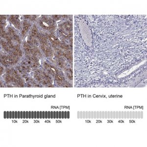 Anti-PTH antibody produced in rabbit 